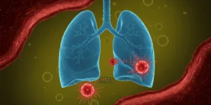 Symbolic illustration showing two lungs with glowing CEA and CYFRA 21-1 molecular structures floating in bloodstream, vibrant red cancer cells contrasting with healthy blue tissue, diagnostic visualization with high-tech medical aesthetic